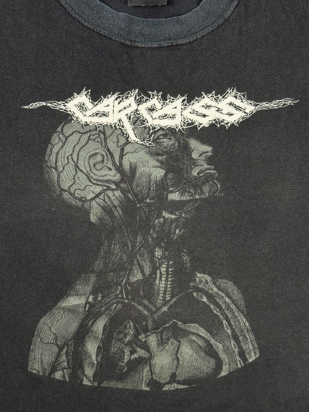 Nahaufnahme des vorderen Siebdrucks mit dem klassischen Carcass-Logo und der anatomischen Illustration eines menschlichen Kopfes mit sichtbaren Gehirn- und Blutbahnen.