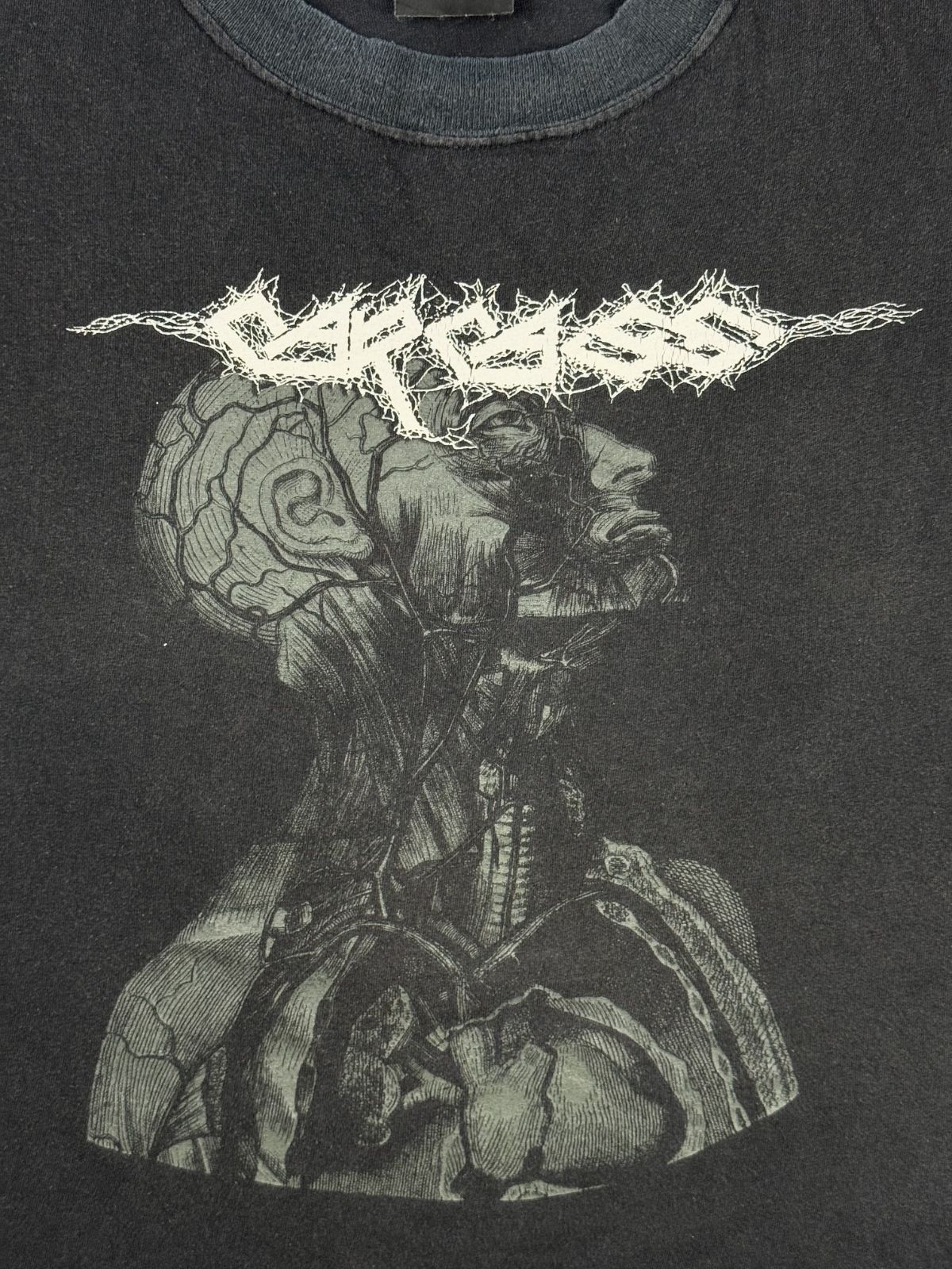 Nahaufnahme des vorderen Siebdrucks mit dem klassischen Carcass-Logo und der anatomischen Illustration eines menschlichen Kopfes mit sichtbaren Gehirn- und Blutbahnen.